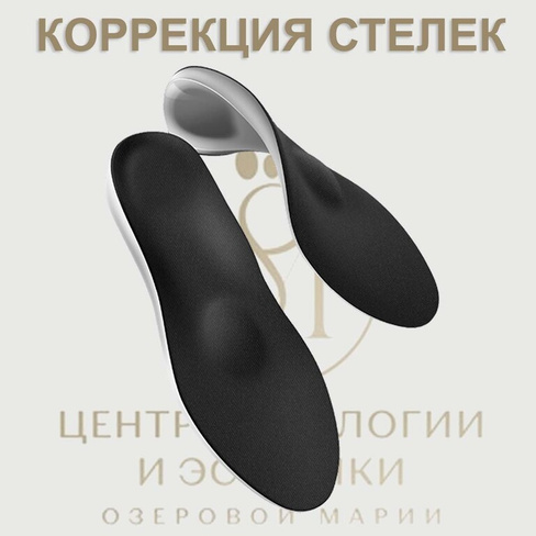 Коррекция стелек